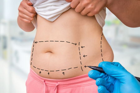 tratamientos de nutricion por lindai