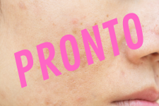lindai, consejera para tratamientos de acne